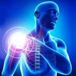 Подвывих плеча: причины, симптомы и лечение