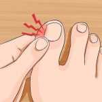 Болит большой палец на ноге возле ногтя: возможные причины, методы лечения
