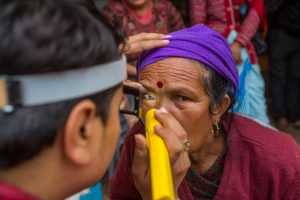 Трахома глаза: симптомы и лечение