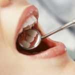 Как снять опухоль после удаления зуба