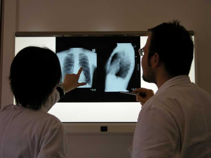 При подозрении на перелом ребер необходимо как можно скорее сделать рентген грудной клетки