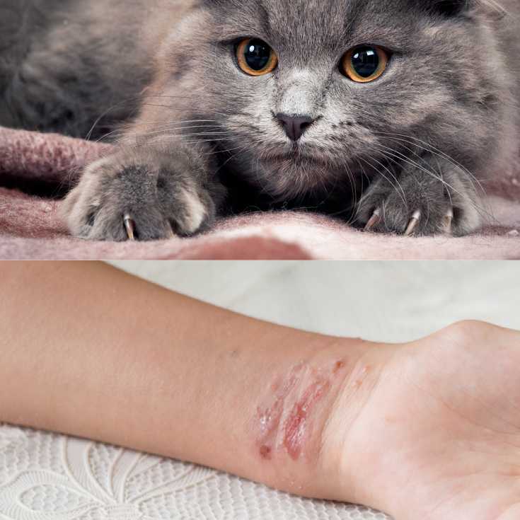 Можно ли заразиться от царапины кошки