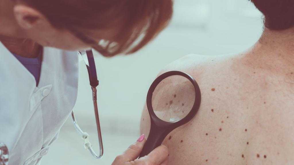 Диагностика злокачественных опухолей кожи