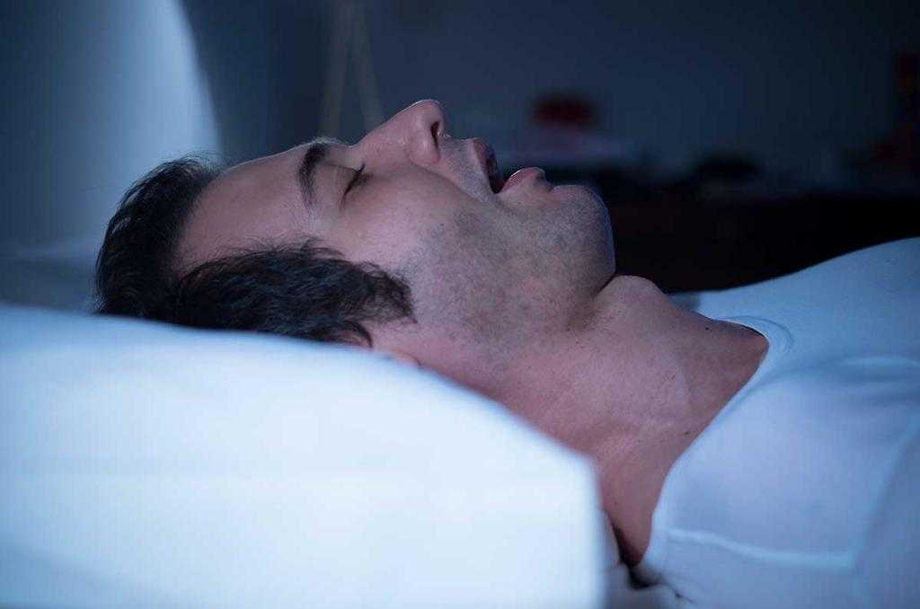 Обструктивное апноэ сна