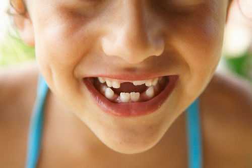 молочные зубы у взрослого человека
