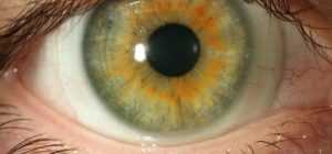 Хрусталик - это важный элемент оптической системы глаза. Строение и функции хрусталика