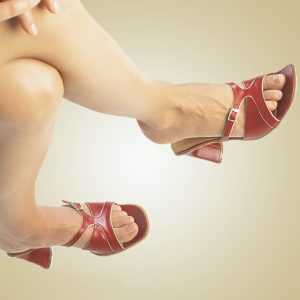 Как вылечить варикозное расширение вен на ногах