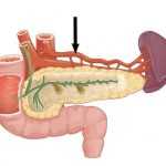 Селезеночная артерия: анатомия, частые заболевания и методы лечения