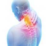 От чего болит шея: причины, виды боли, возможные проблемы и лечение