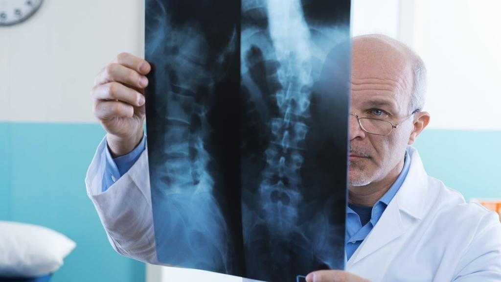 Выявить аномалию помогает рентген