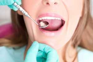 Как определить, какой зуб болит, если ноет вся челюсть?