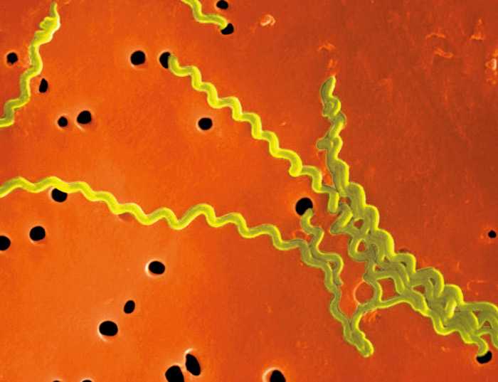 бактерия лептоспира