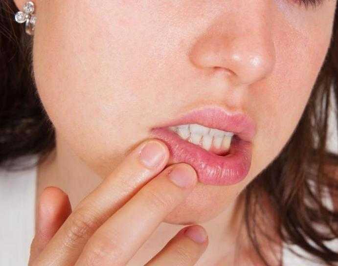 Опухла губа: аллергическая реакция
