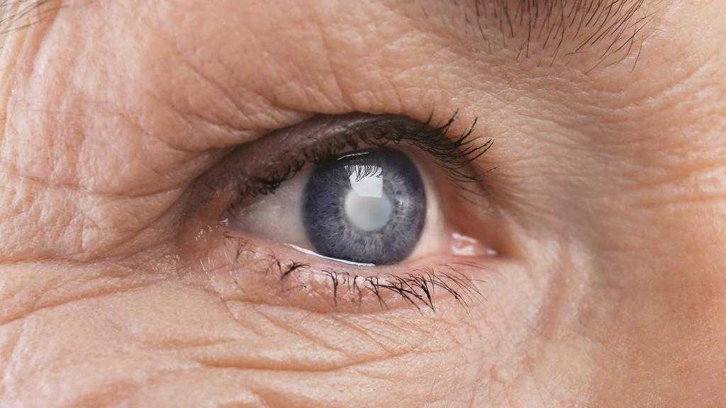 заболевание катаракта
