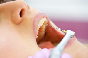 Восстановление зуба при наличии корня: способы, технология, отзывы
