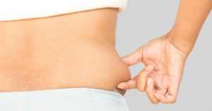 Операция по удалению жира (липосакция): показания, этапы, противопоказания