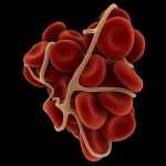 Тромбин - это... Функции в процессе свертывания крови