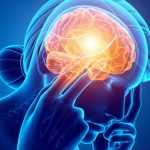 Мигренозная аура: причины, симптомы и диагностика, методы лечения