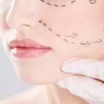 Эндоскопическая подтяжка лица: отзывы клиентов, рекомендации косметологов, результаты до и после