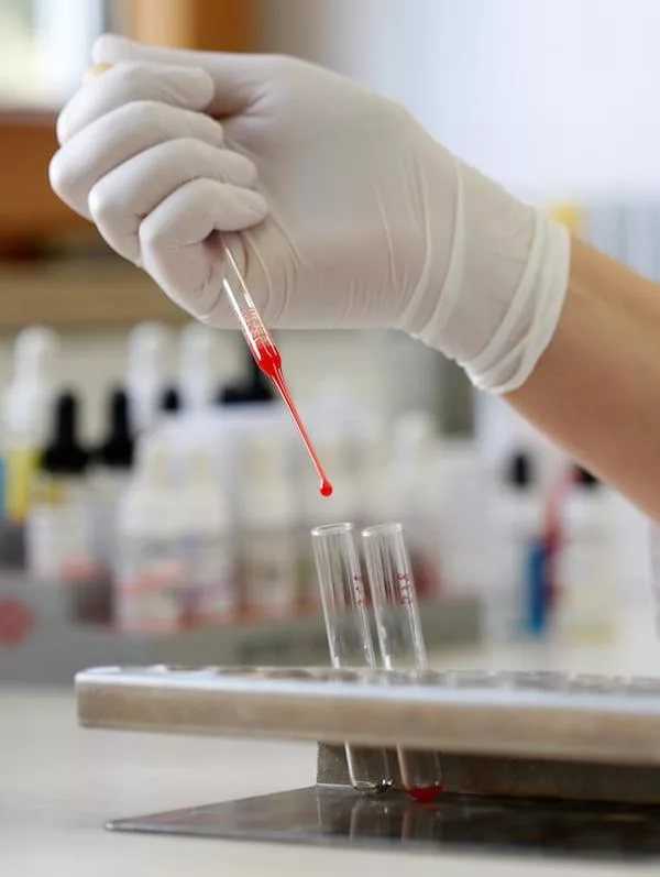 Как правильно называется анализ крови на ВИЧ