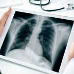 Вред рентгена. Что такое рентгенография? Как часто можно делать рентген без вреда для здоровья