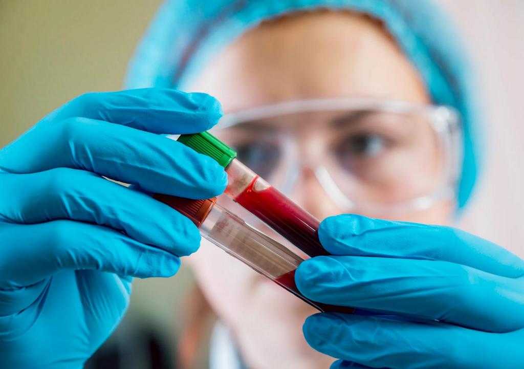 Какие анализы крови при ВИЧ