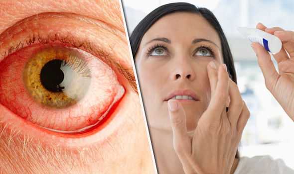 Чем лечить красные глаза