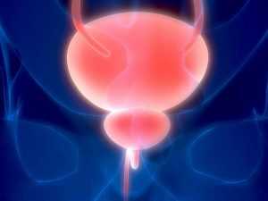 Полип в мочевом пузыре у женщин: симптомы, причины и методы лечения