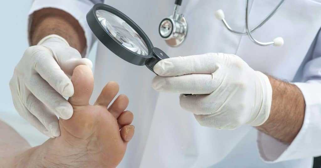 как распознать рак кожи на ноге