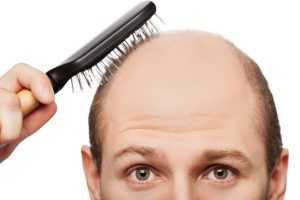 Выпадают волосы и чешется кожа головы: причины и лечение